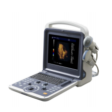 Цифровая ультразвуковая диагностическая система визуализации УЗИ К6 