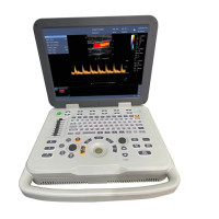 Цифровая портативная система УЗ диагностики К0 Advanced