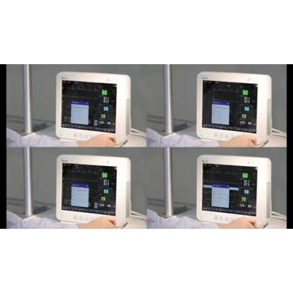 Монитор пациента мультипараметровый ZD 120 Монитор пациента мультипараметровый ZD 120